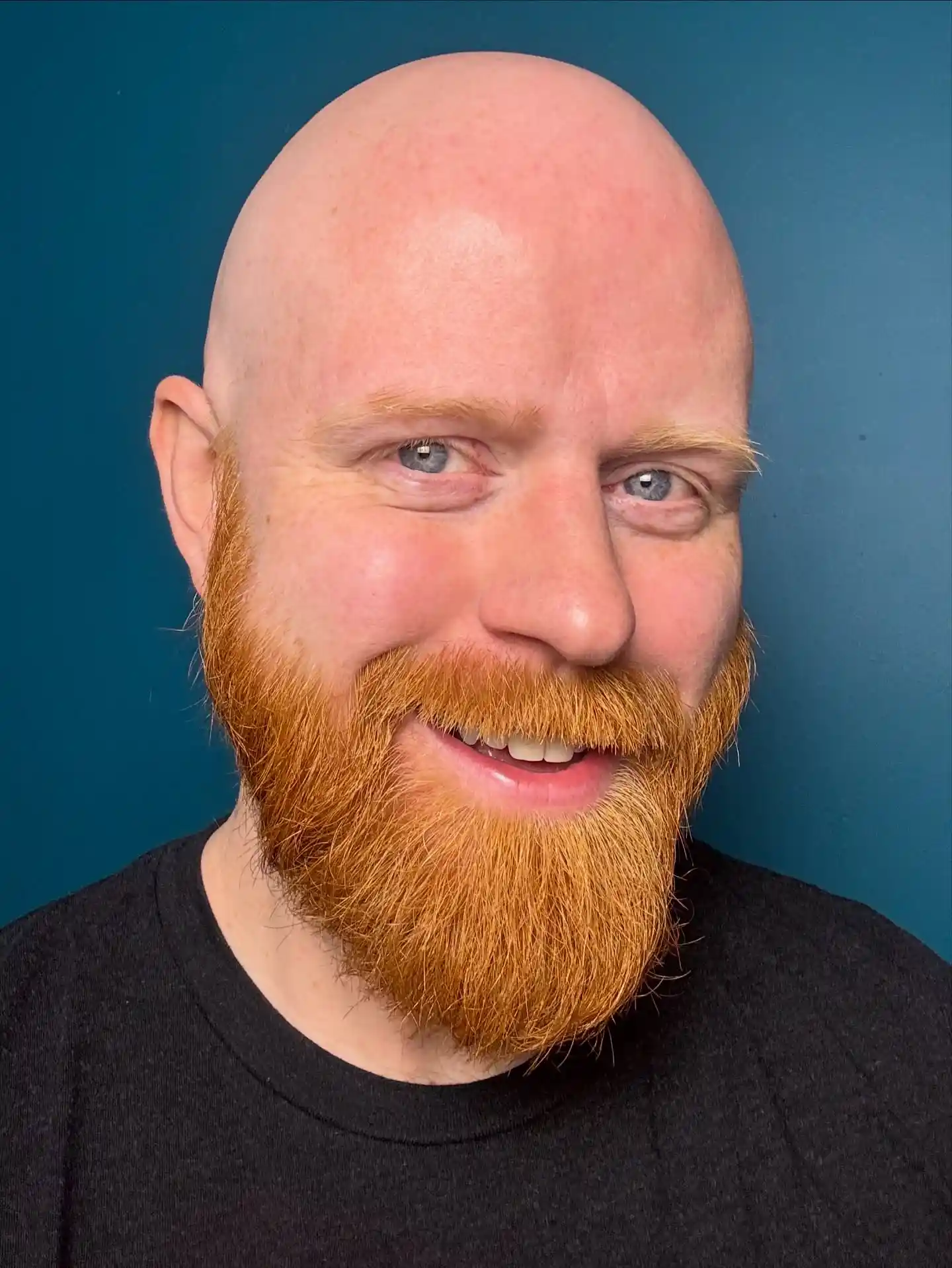 19 Beard Styles for Bald Men Over 40 That Actually Work With Your Face 12 kylemotsinger 1767147901
