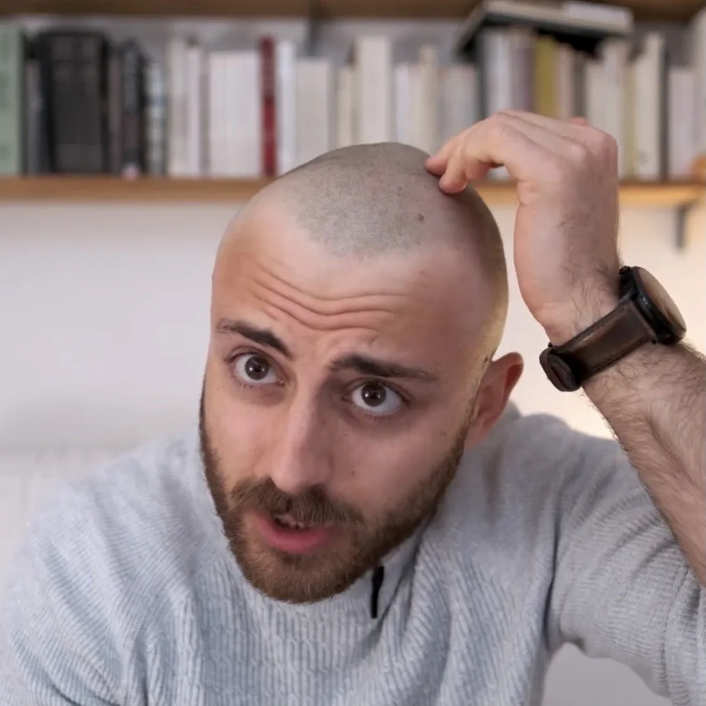 Bald Men Buzz Cut Ideas: 30 Styles Worth Trying 17 onlythebestofmen 1648237252
